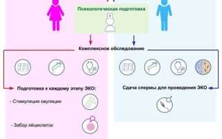 Суть методики ИКСИ