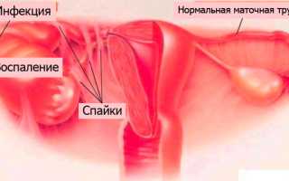 Бесплодие — вечная проблема человечества